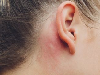 eczema de l'oreille